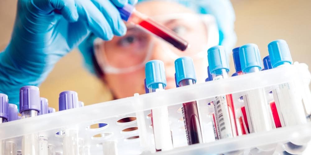 Blood test shows promise for detecting testicular cancer when standard markers miss